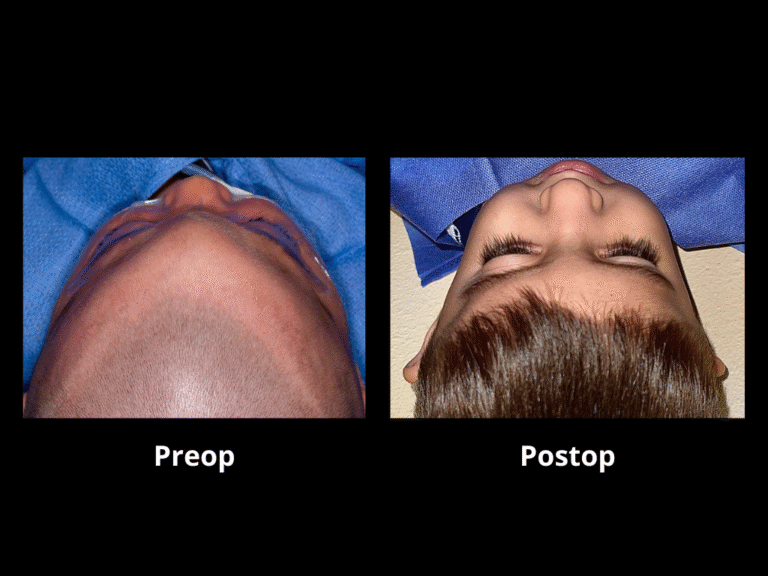 11 Carillo Chavez, Leonel