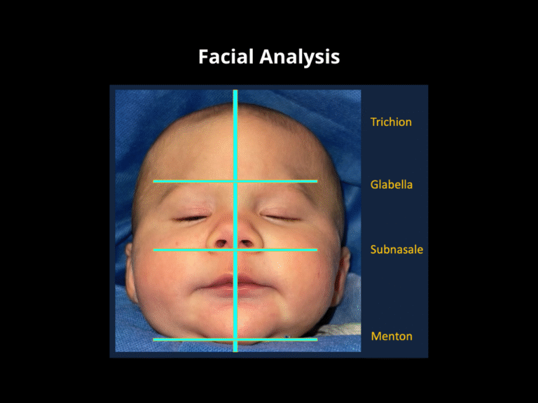 69 Endoscopic Treatment
